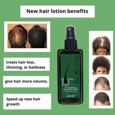 Hair Growth & New Hair Lotion + Derma Roller – Combo Deal