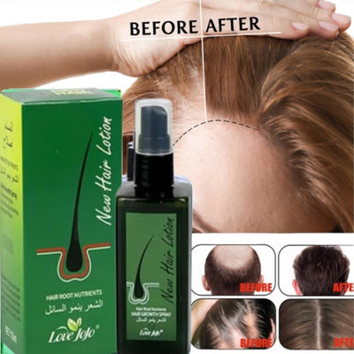 Hair Growth & New Hair Lotion + Derma Roller – Combo Deal