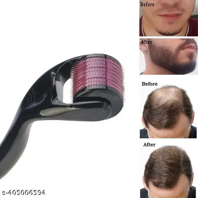 Hair Growth & New Hair Lotion + Derma Roller – Combo Deal